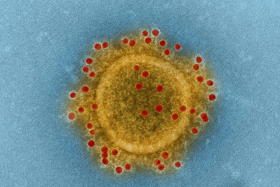 Coronavirus Covid-19