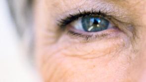 Free eye test for AMD in Leitrim this month