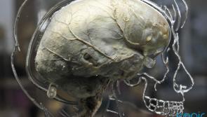 New research suggests memory can be improved by electrical brain stimulation