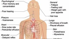 Healthy Living: Dealing with hypothyroidism