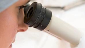 65% of irish adults have never undergone a cancer screening test, but 76% are interested in trying