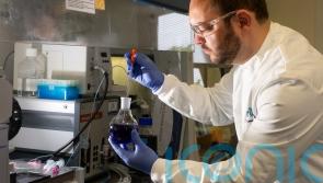 State of the art research into &lsquo;mini brains&rsquo; at University of Galway