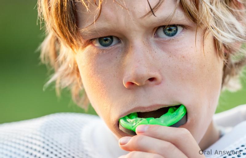 Children not wearing properly fitting mouth guards 