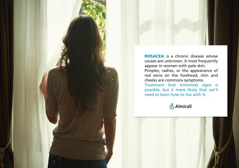 Spring can be challenging  for Rosacea sufferers