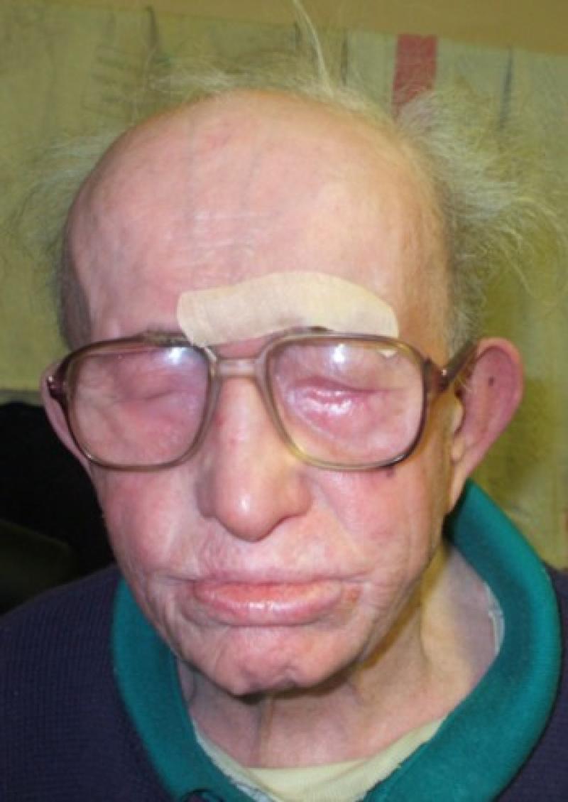 Full Report - Elderly Mohill man was stabbed in the neck