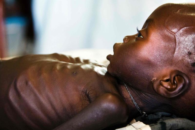 Famine in South Sudan