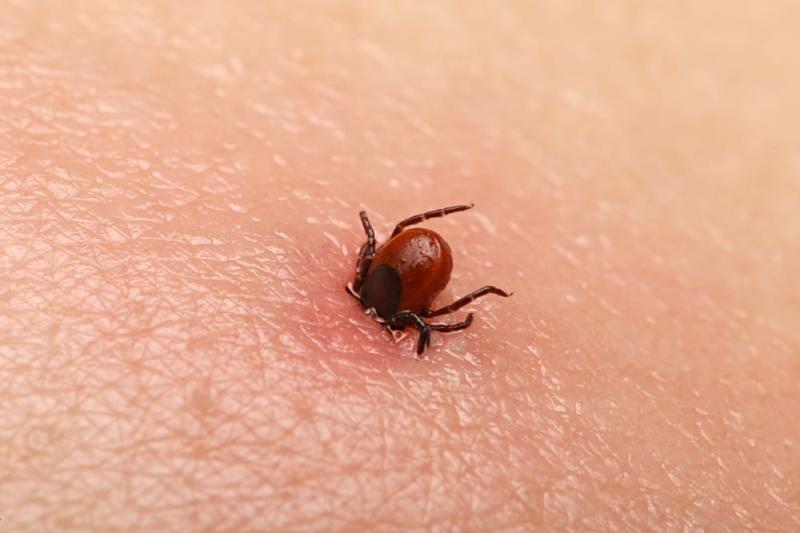 Lyme disease sufferers in Kilkenny