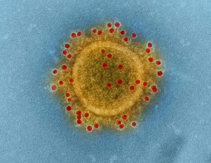 Coronavirus Covid-19