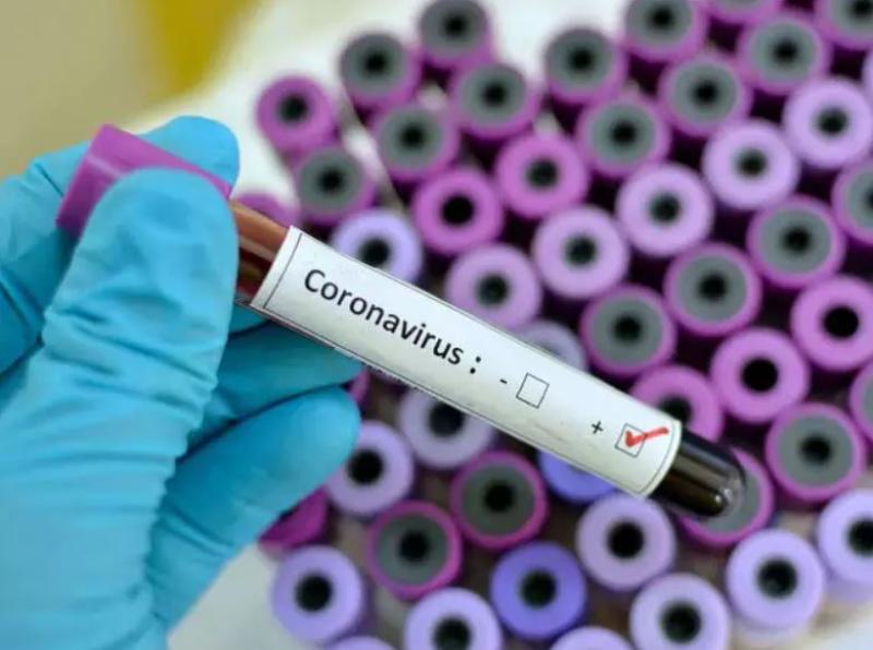 HSE West confirm ‘no cases of Covid-19 in Boyle’