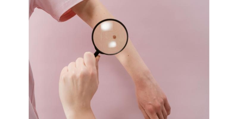 Leitrim TD urges action in Dáil over severely strained dermatology services in north west